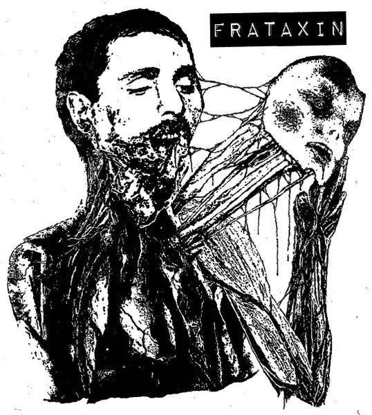 Frataxin : Frataxin (Cass, Ltd, C16)
