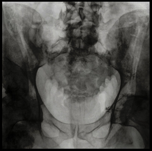 Blood Rhythms : Civil War (LP, 180)