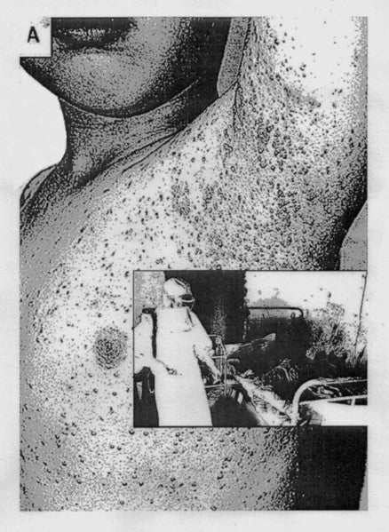 Bacillus : Quarantined (Cass, Album, C30)