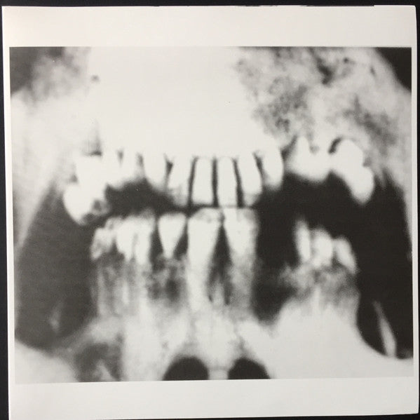 Charred Remains A.K.A Man Is The Bastard : Abundance Of Guns (10", Ltd, RE, Gre)